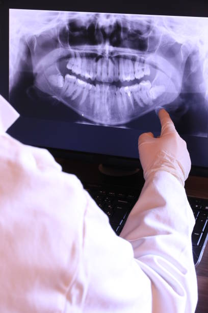 Best Chipped Tooth Repair Near Me  in Iron Mountain, MI