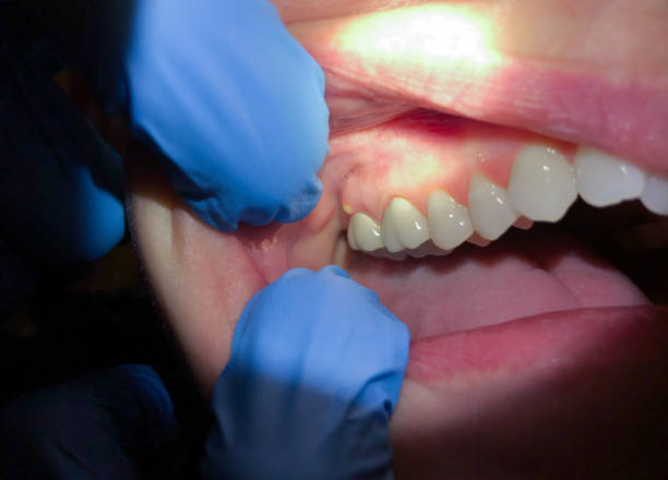 Best Tooth Pain Emergency Relief  in Iron Mountain, MI
