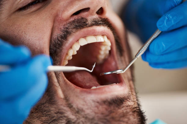 Best Emergency Tooth Extraction  in Iron Mountain, MI